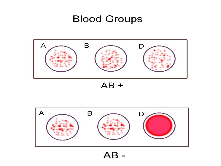 Phase II Medicine- Blood Module May 2008 13 