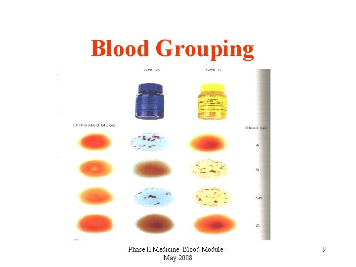 Blood Grouping Phase II Medicine- Blood Module May 2008 9 
