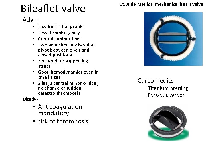 Bileaflet valve St. Jude Medical mechanical heart valve Adv – Low bulk - flat