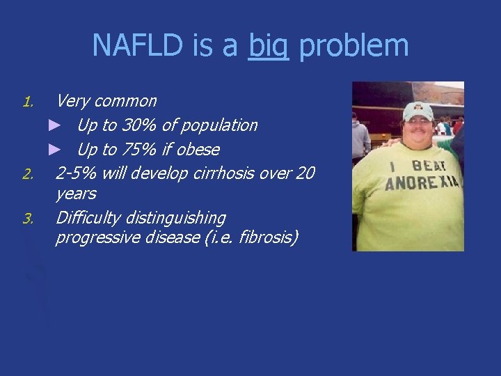 NAFLD is a big problem Very common ► Up to 30% of population ►