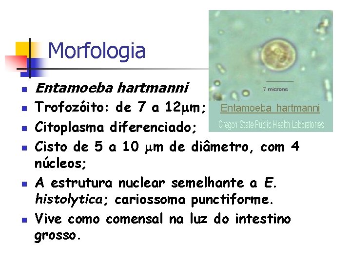 Morfologia n n n Entamoeba hartmanni Trofozóito: de 7 a 12 m; Citoplasma diferenciado;