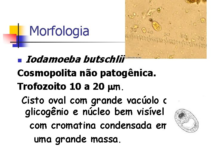 Morfologia n Iodamoeba butschlii Cosmopolita não patogênica. Trofozoito 10 a 20 m. Cisto oval