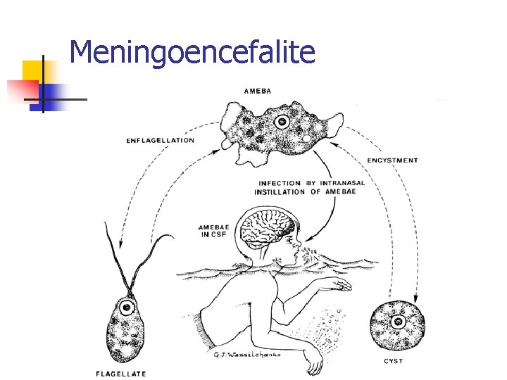 Meningoencefalite 