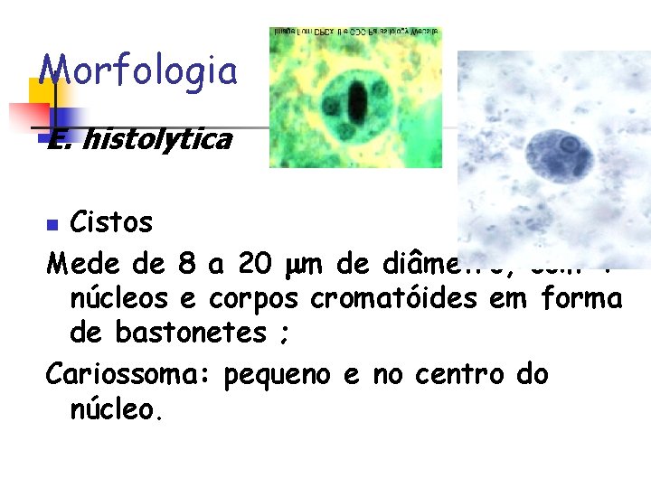 Morfologia E. histolytica Cistos Mede de 8 a 20 m de diâmetro, com 4