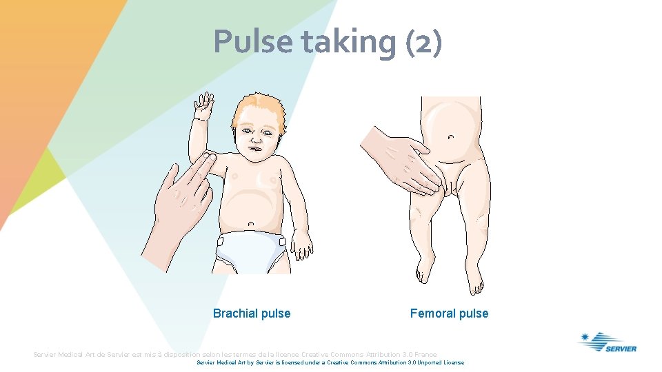 Pulse taking (2) Brachial pulse Femoral pulse Servier Medical Art de Servier est mis