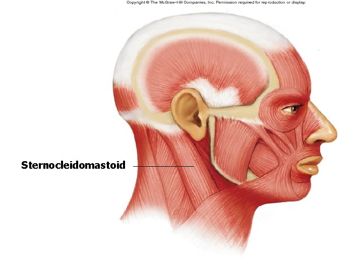Sternocleidomastoid Sternocleidomastoid