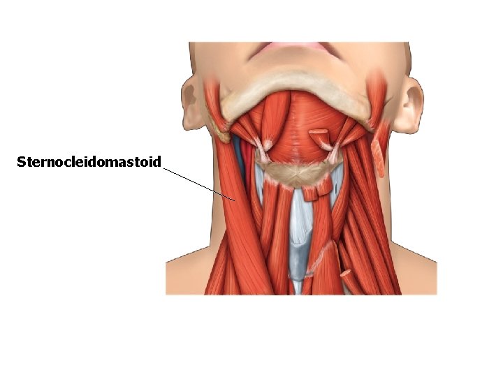 Sternocleidomastoid Sternocleidomastoid
