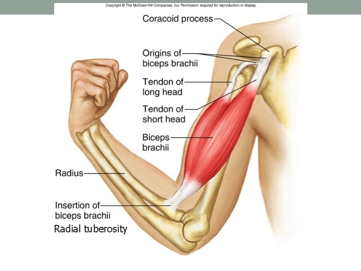 Radial tuberosity Radial tuberosity