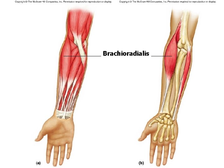 Brachioradialis Brachioradialis