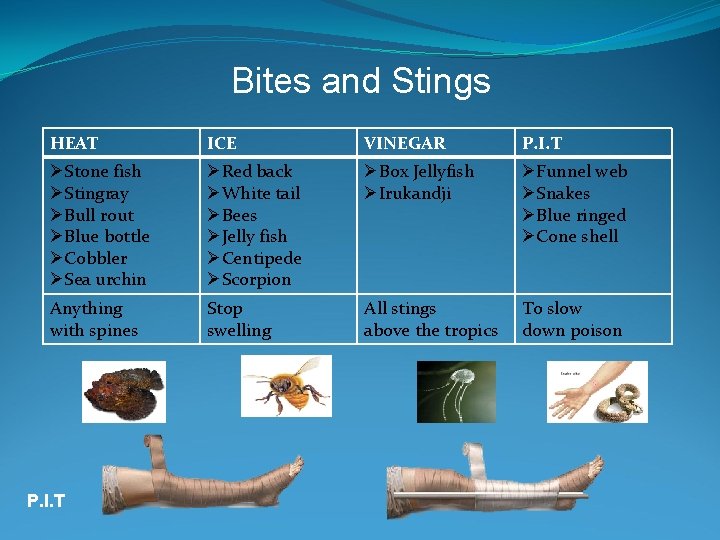 Bites and Stings HEAT ICE VINEGAR P. I. T ØStone fish ØStingray ØBull rout