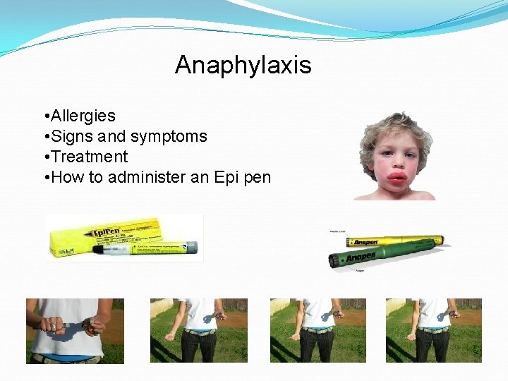 Anaphylaxis • Allergies • Signs and symptoms • Treatment • How to administer an