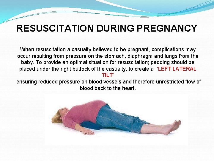 RESUSCITATION DURING PREGNANCY When resuscitation a casualty believed to be pregnant, complications may occur