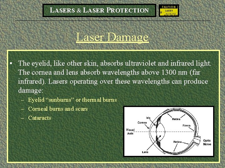 LASERS & LASER PROTECTION Laser Damage • The eyelid, like other skin, absorbs ultraviolet