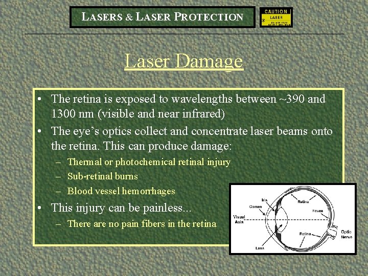 LASERS & LASER PROTECTION Laser Damage • The retina is exposed to wavelengths between