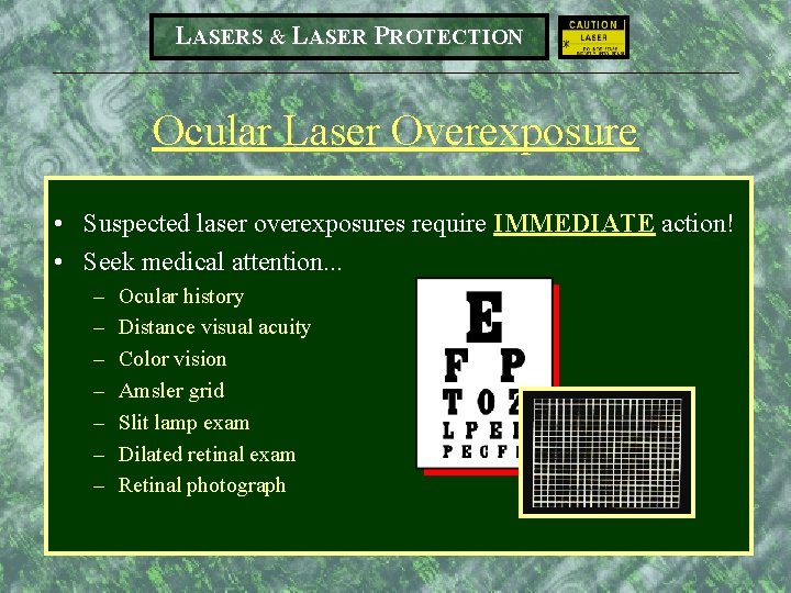 LASERS & LASER PROTECTION Ocular Laser Overexposure • Suspected laser overexposures require IMMEDIATE action!