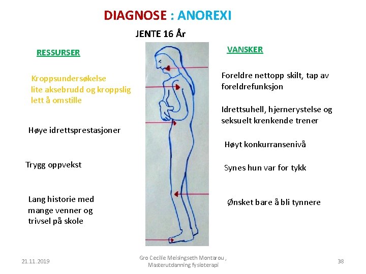 DIAGNOSE : ANOREXI JENTE 16 År VANSKER RESSURSER Kroppsundersøkelse lite aksebrudd og kroppslig lett