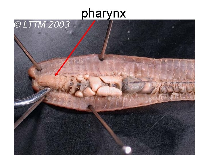 pharynx 