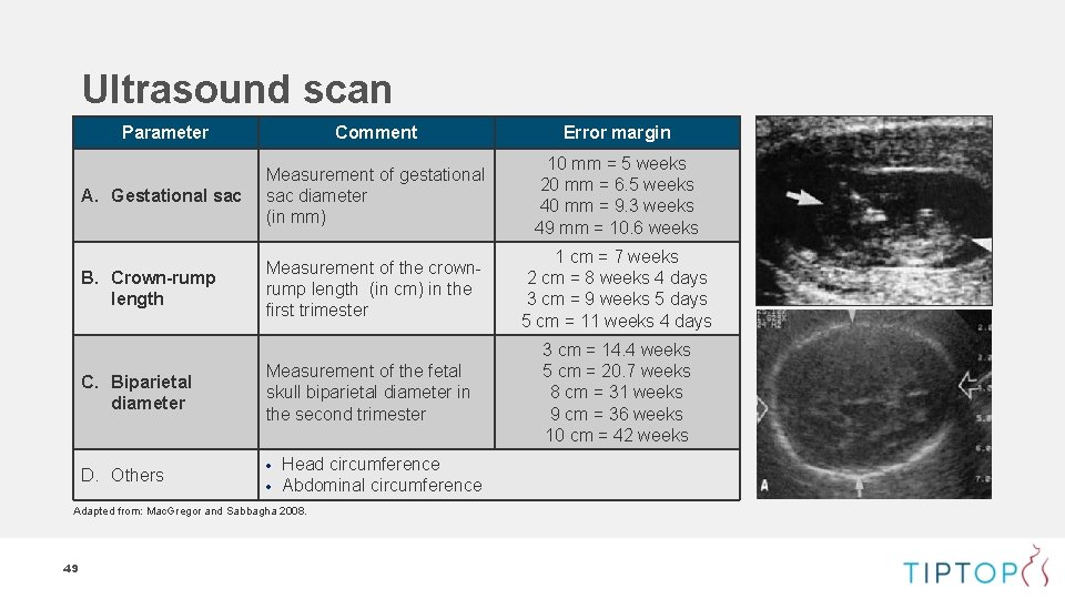 Ultrasound scan Parameter Comment Error margin A. Gestational sac Measurement of gestational sac diameter