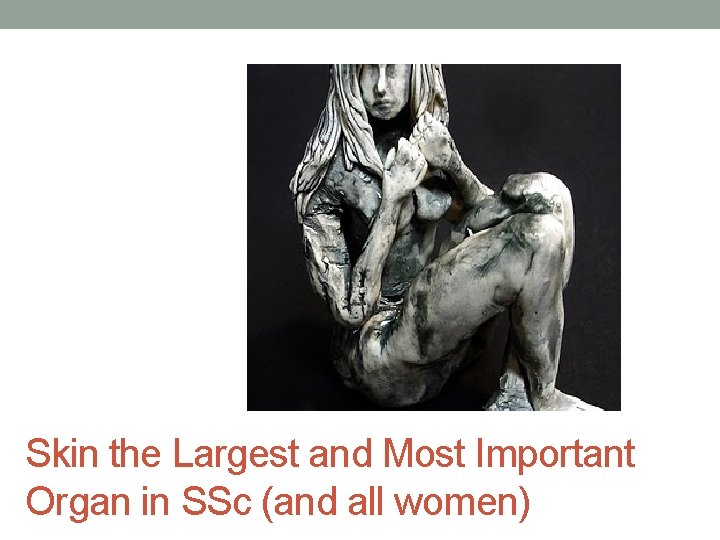 Skin the Largest and Most Important Organ in SSc (and all women) 