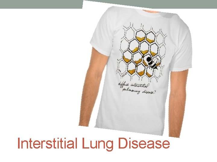 Interstitial Lung Disease 