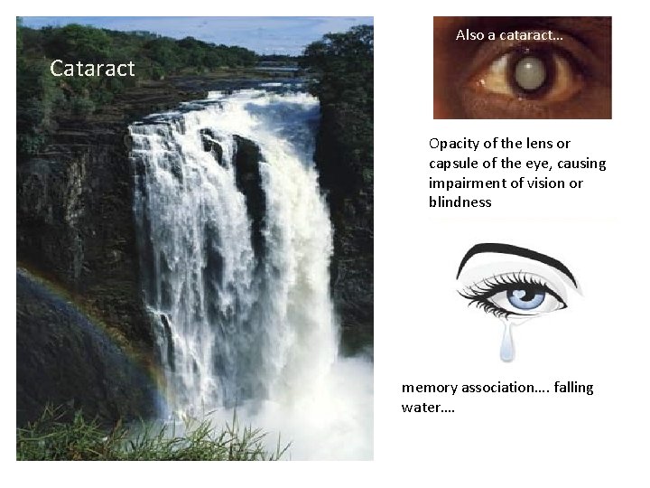 Also a cataract… Cataract Opacity of the lens or capsule of the eye, causing