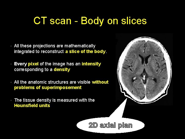 CT scan - Body on slices • All these projections are mathematically integrated to