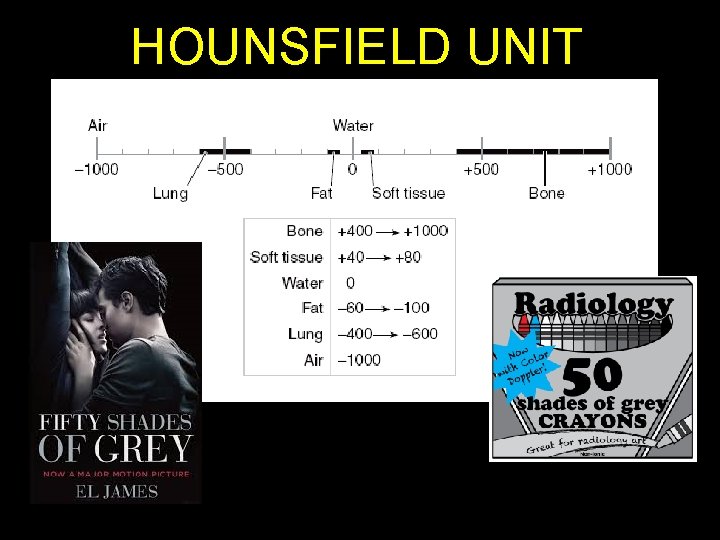 HOUNSFIELD UNIT 