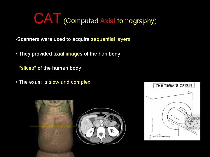  CAT (Computed Axial tomography) • Scanners were used to acquire sequential layers •