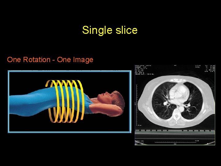 Single slice One Rotation - One Image 
