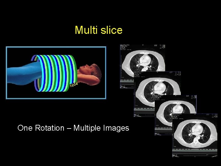 Multi slice One Rotation – Multiple Images 