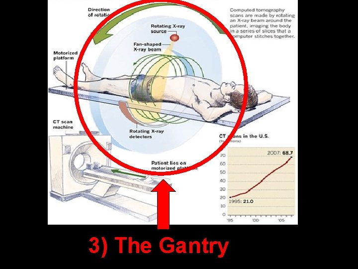 3) The Gantry 