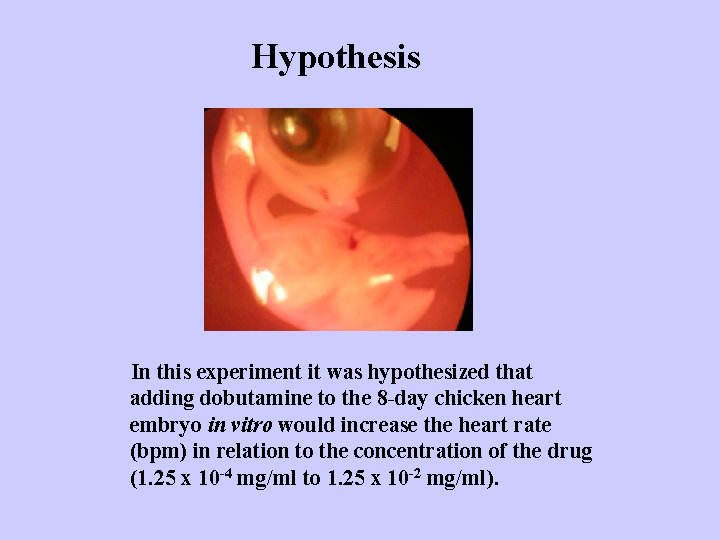 Hypothesis In this experiment it was hypothesized that adding dobutamine to the 8 -day