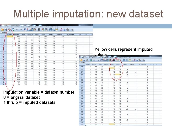 Multiple imputation: new dataset Yellow cells represent imputed values Imputation variable = dataset number