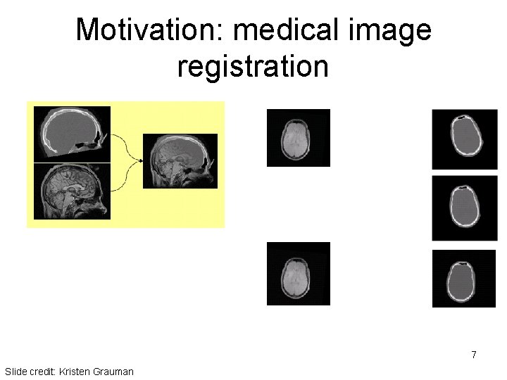 Motivation: medical image registration 7 Slide credit: Kristen Grauman 
