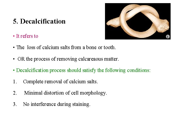 5. Decalcification • It refers to • The loss of calcium salts from a