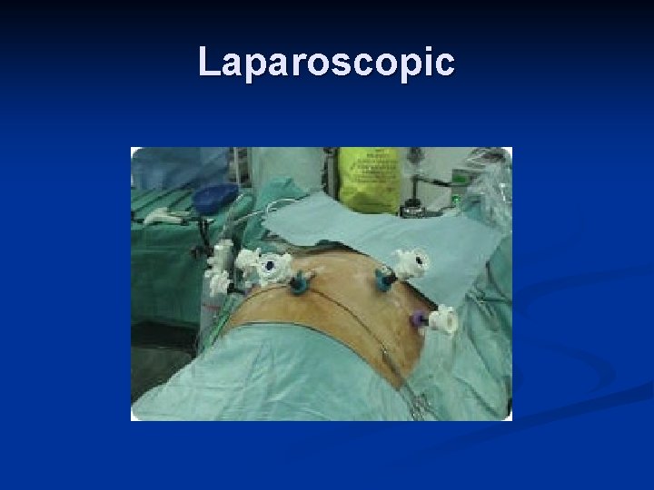 Laparoscopic 