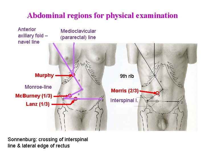 Abdominal regions for physical examination Anterior axillary fold – navel line Medioclavicular (pararectal) line Abdominal regions for physical examination Anterior axillary fold – navel line Medioclavicular (pararectal) line