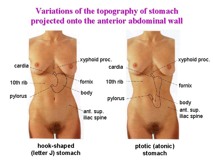 Variations of the topography of stomach projected onto the anterior abdominal wall cardia 10 Variations of the topography of stomach projected onto the anterior abdominal wall cardia 10