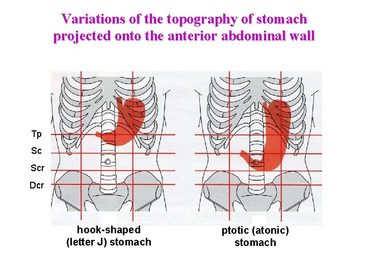 Variations of the topography of stomach projected onto the anterior abdominal wall Tp Sc Variations of the topography of stomach projected onto the anterior abdominal wall Tp Sc