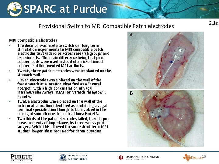 SPARC at Purdue 2. 1 c Provisional Switch to MRI Compatible Patch electrodes MRI