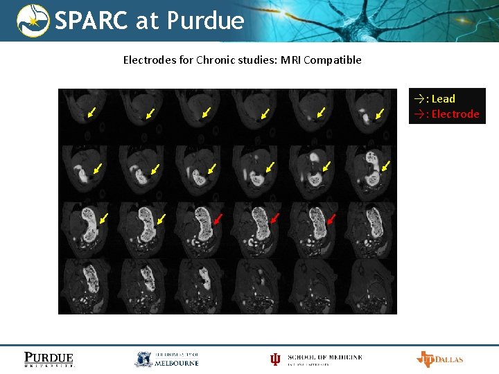 SPARC at Purdue Electrodes for Chronic studies: MRI Compatible →: Lead →: Electrode 