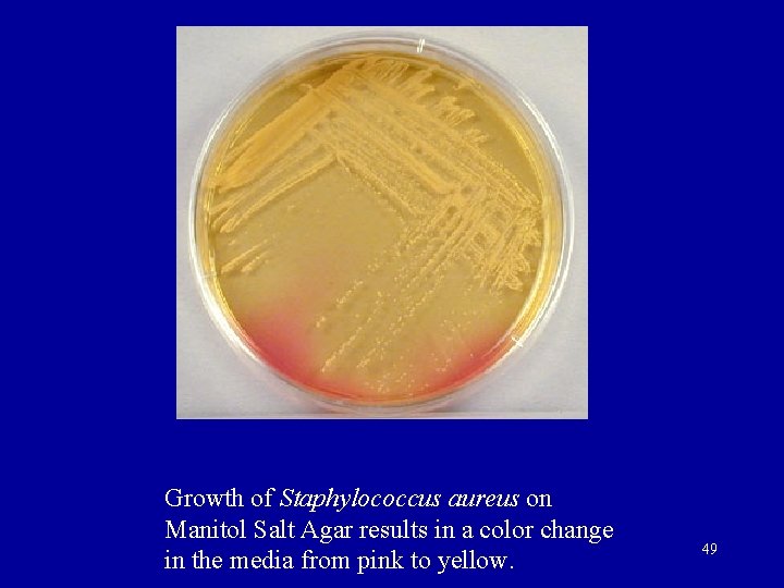 Growth of Staphylococcus aureus on Manitol Salt Agar results in a color change in