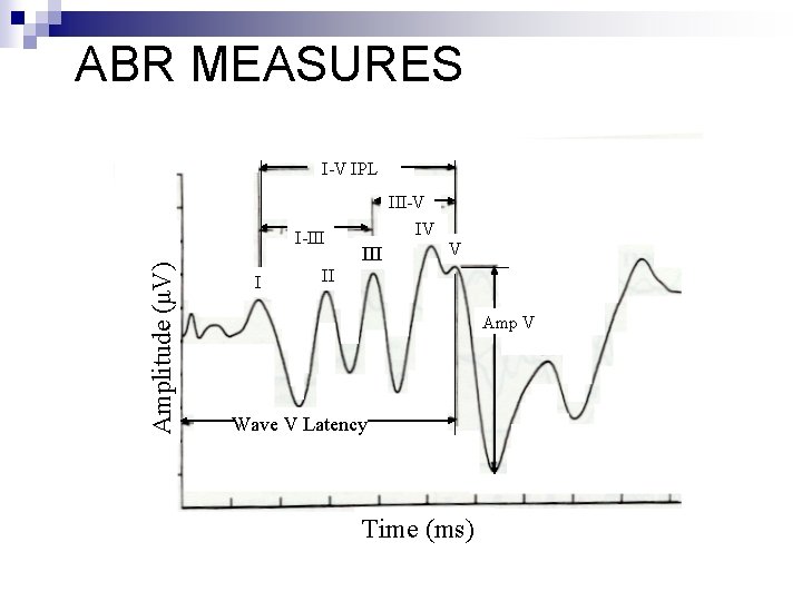 ABR MEASURES I-V IPL Amplitude (μV) I-III I III-V IV III V II Amp