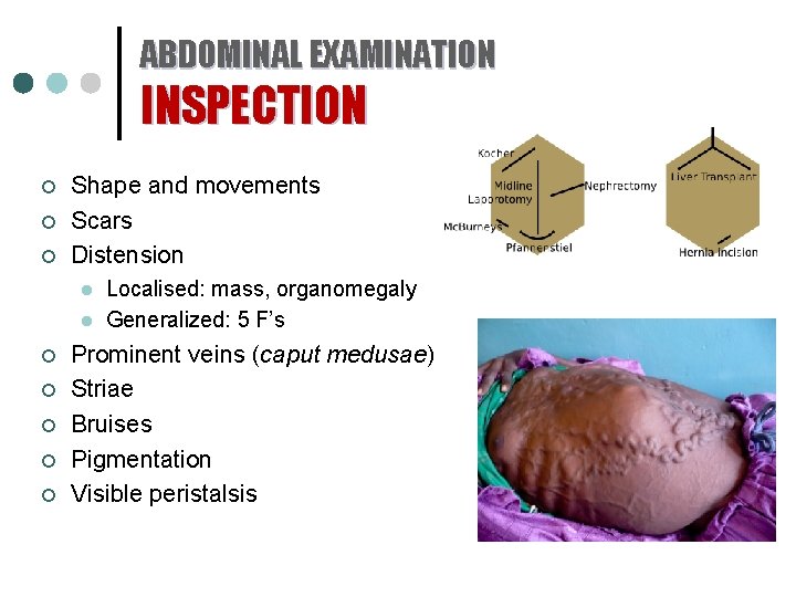 ABDOMINAL EXAMINATION INSPECTION ¢ ¢ ¢ Shape and movements Scars Distension l l ¢