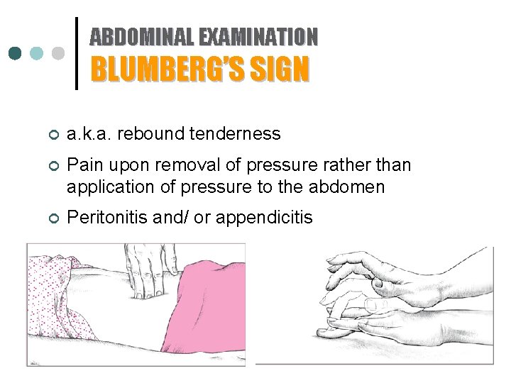 ABDOMINAL EXAMINATION BLUMBERG’S SIGN ¢ a. k. a. rebound tenderness ¢ Pain upon removal