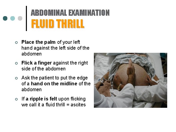 ABDOMINAL EXAMINATION FLUID THRILL ¢ Place the palm of your left hand against the