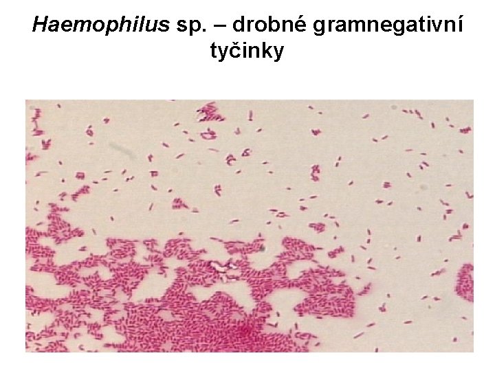 Haemophilus sp. – drobné gramnegativní tyčinky 