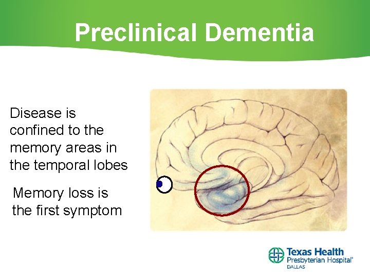 Preclinical Dementia Disease is confined to the memory areas in the temporal lobes Memory