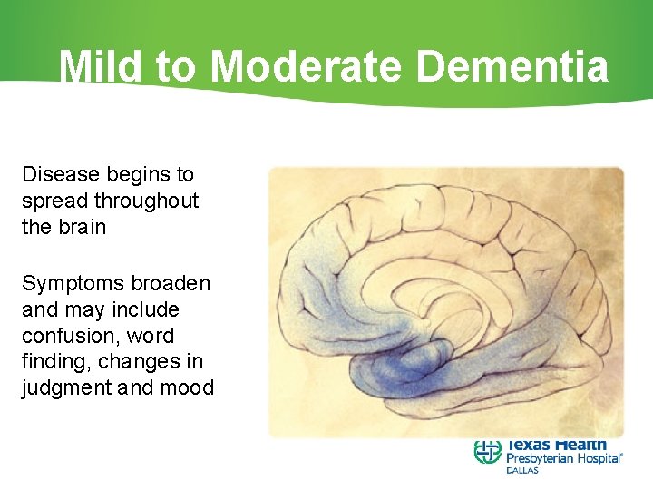 Mild to Moderate Dementia Disease begins to spread throughout the brain Symptoms broaden and