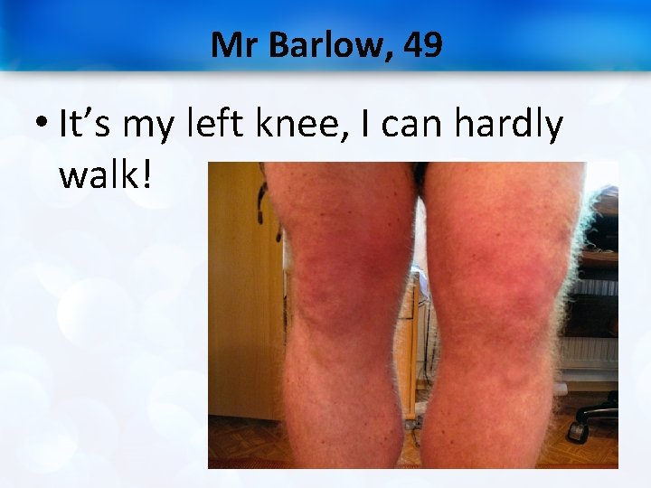 Mr Barlow, 49 • It’s my left knee, I can hardly walk! 